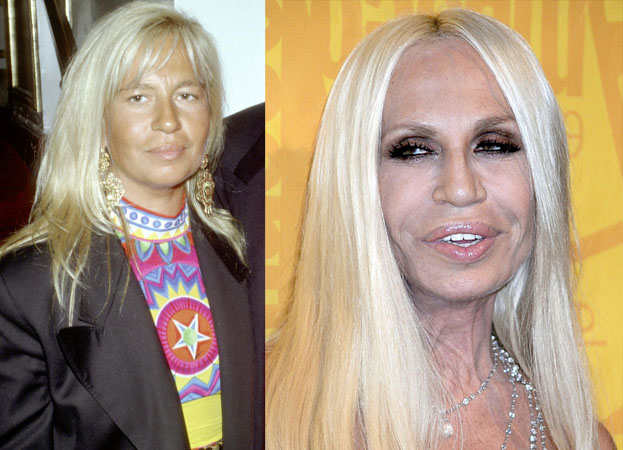 POTWORNIE WYCHUDZONA Donatella Versace! (ZDJĘCIA)